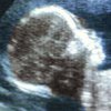 На УЗИ нерожденного ребенка увидели призрака (фото)