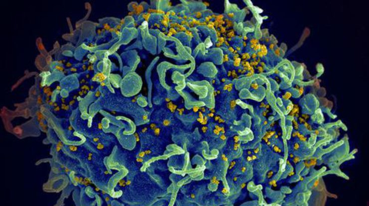 Вирусологам удалось блокировать размножение ВИЧ