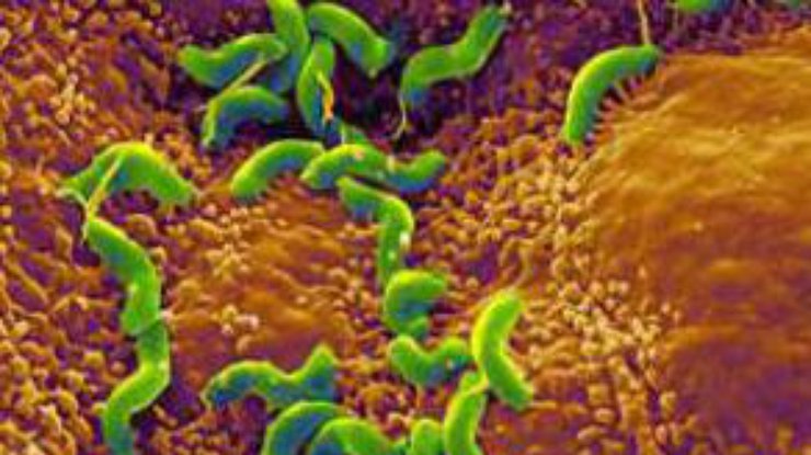 Золотистый стафилококк - вид грамположительных бактерий