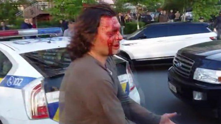 В Киеве полиция при задержании разбила голову олимпийскому чемпион. Фото: кадр из видео
