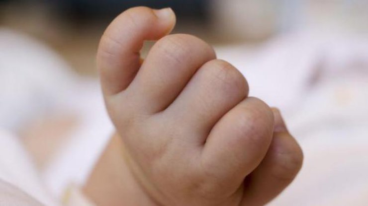В Китае родился ребенок с редким заболеванием 