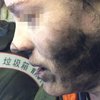 На борту самолета у женщины в ушах взорвались наушники (фото) 