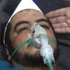 Химическая атака в Сирии: погибли несколько десятков человек