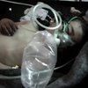Война в Сирии: военные использовали запрещенное химическое оружие 
