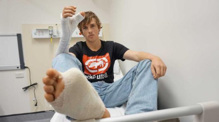 Австралийцу пересадили большой палец ноги на руку