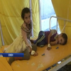 У Йемені вирує епідемія холери