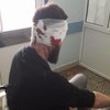 В Харькове жестоко избили депутата