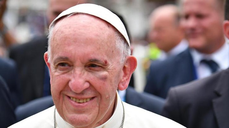Папа Римский получил в Колумбии травму 