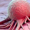 Ученые нашли способ победить рак