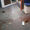 В Киеве обломок трамвая ранил женщину 