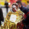 Взрыв в Париже: появилась информация о пострадавших
