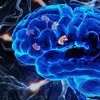  Ученые обнаружили новый симптом болезни Альцгеймера
