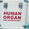 В Европе впервые пересадили человеку сразу три органа