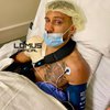 "Снова четыре дырки": измученный Ломаченко показал плечо после операции (видео)