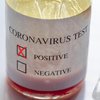 Вернувшиеся из-за границы украинцы не должны сдавать тест на коронавирус - Минздрав