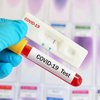 ОАЭ передали Украине экспресс-тесты на коронавирус