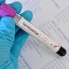 Первый случай коронавируса подтвержден еще в одной стране