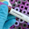 В Ивано-Франковской области с подозрением на коронавирус госпитализировали 9 человек