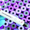 В Николаевской области зафиксировали первые случаи коронавируса