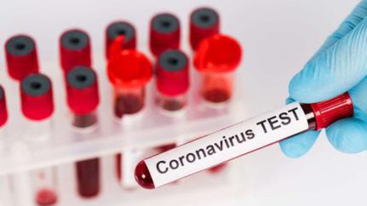Тест на коронавирус/Фото: pixabay