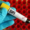 Пандемия коронавируса привела к дефициту лекарств от ВИЧ