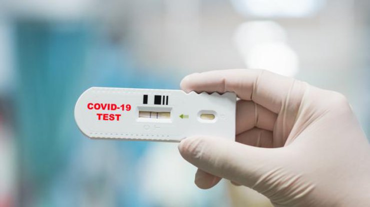 Тест на коронавирус/ Фото: Getty Images