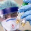 В Бразилии выявили феноменальные "двойные" случаи коронавируса