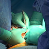 В Україні запрацювала єдина база трансплантації