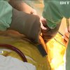 Українські кардіохірурги запровадили унікальну методику лікування серцевої хвороби