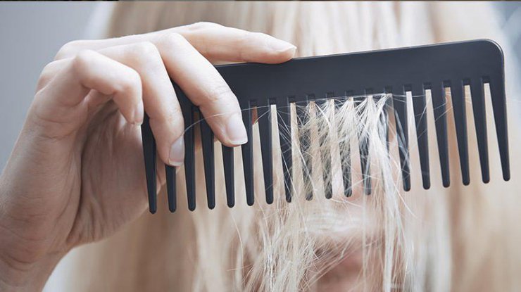 Фото: выпадение волос / daily-med.com.ua