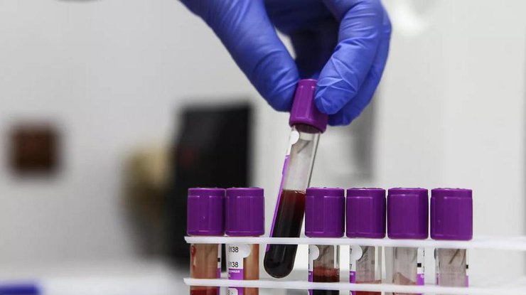 Рак крові виявить дослідження крові