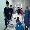 Турецькі лікарі успішно розділили півторарічних сіамських близнюків