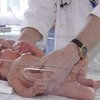 Медики предлагают оперировать детей еще до рождения