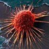 Выключение дефектного гена остановит рост раковой опухоли