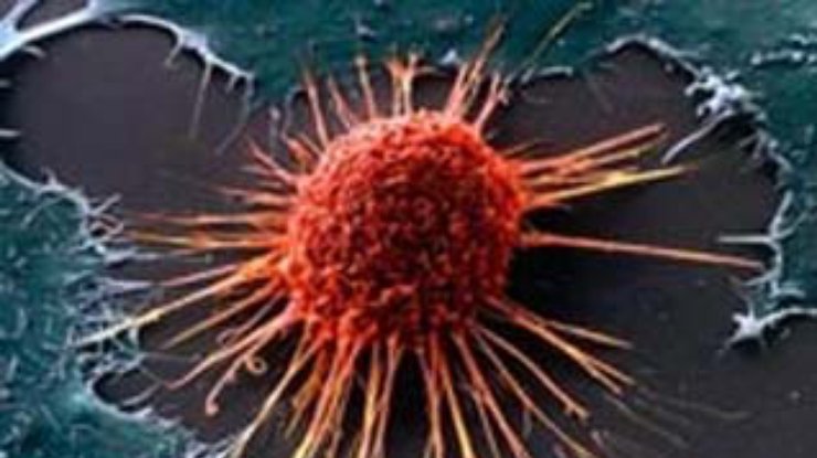 Выключение дефектного гена остановит рост раковой опухоли