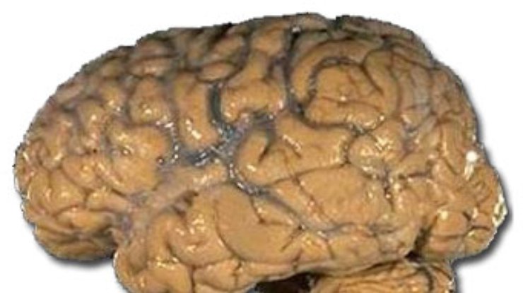 Интеллект зависит от физических параметров коры мозга