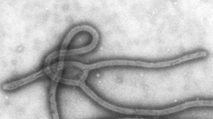 Вакцина против лихорадки Эбола впервые испытана на человеке