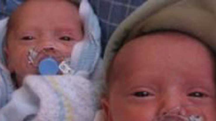 В Британии родились "феноменальные" близнецы