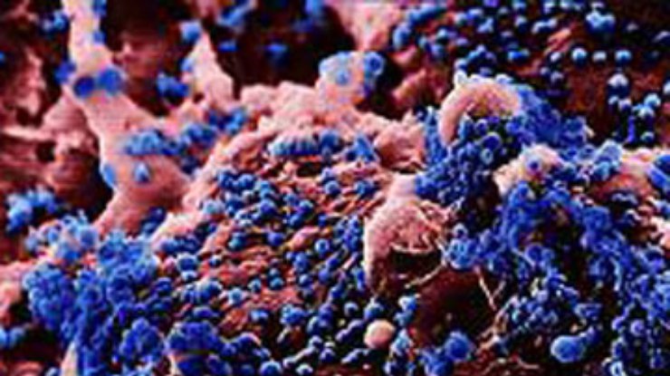 Ученые выявили генетическую природу вируса нового гриппа