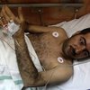 В Бахрейне военные ранили сотни демонстрантов. Пятеро убиты