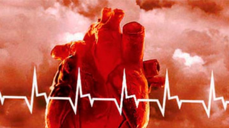 Врачи: 67% украинцев умирают от сердечно-сосудистых заболеваний