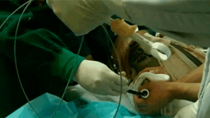 Китайские хирурги спасли жизнь 100-летней черепахи