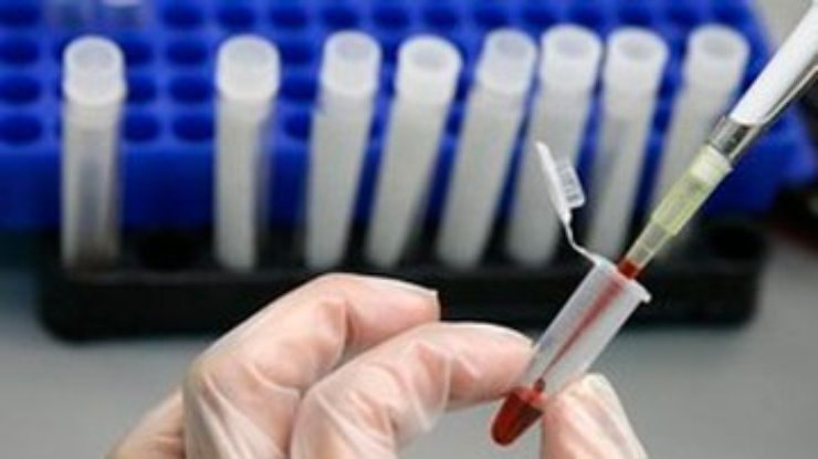 Американский ученый признался, что его вакцина против ВИЧ - подделка