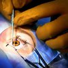Панамские хирурги ослепили девушку во время операции за 13 тысяч долларов