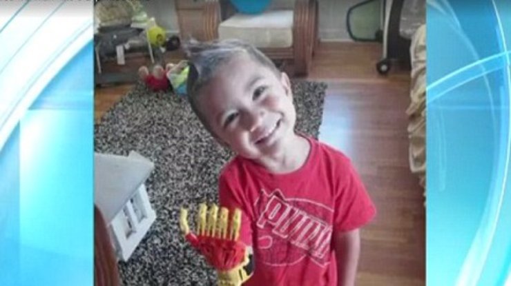 Мальчику Рэйдену напечатали на 3D принтере кисть Железного Человека (видео)