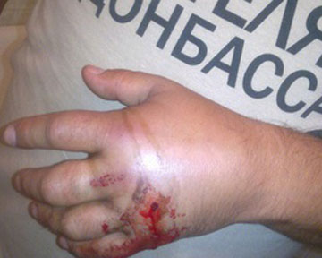 В Киеве стреляли в мужчину в футболке "Спасибо жителям Донбасса"