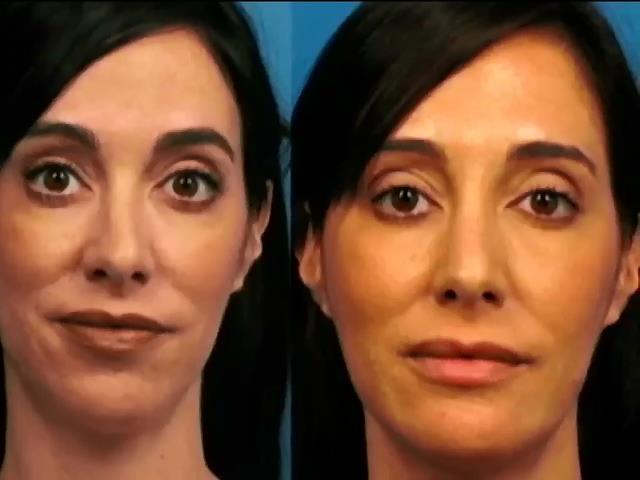 Американка сделала пластику лица для аватара в соцсетях (видео)