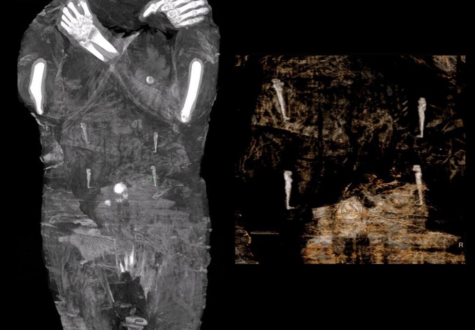 Ученые нашли первую в мире беременную мумию