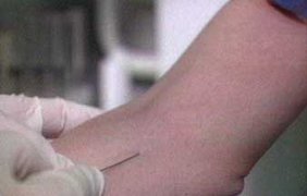 В Киеве создан центр СПИДа