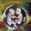 Ученый, создавший Долли, намерен клонировать эмбрион человека